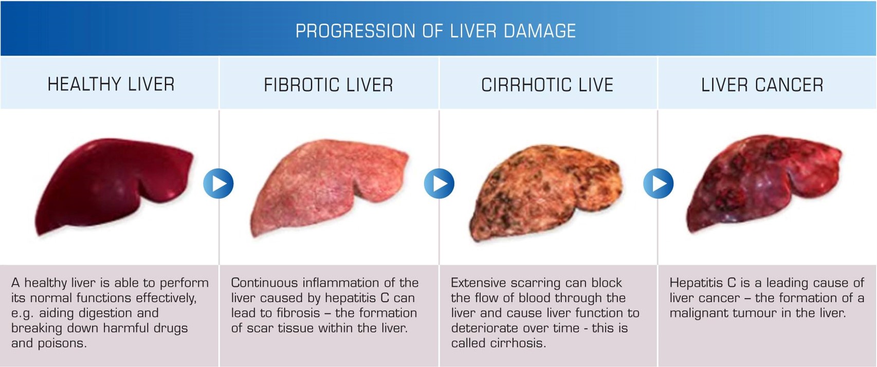 https://www.nascp.gov.ng/default/hepatitis